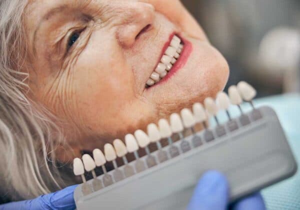 Licówki porcelanowe — Pitshanger Clinic