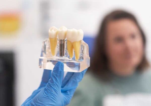 Implanty dentystyczne — Pitshanger Clinic Ealing